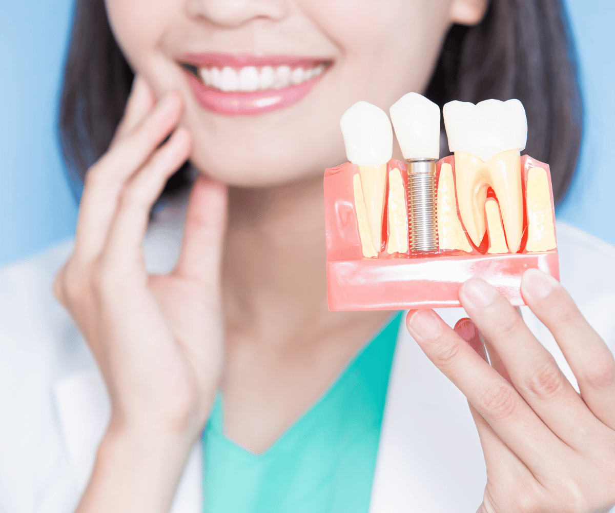 Implantes Dentários