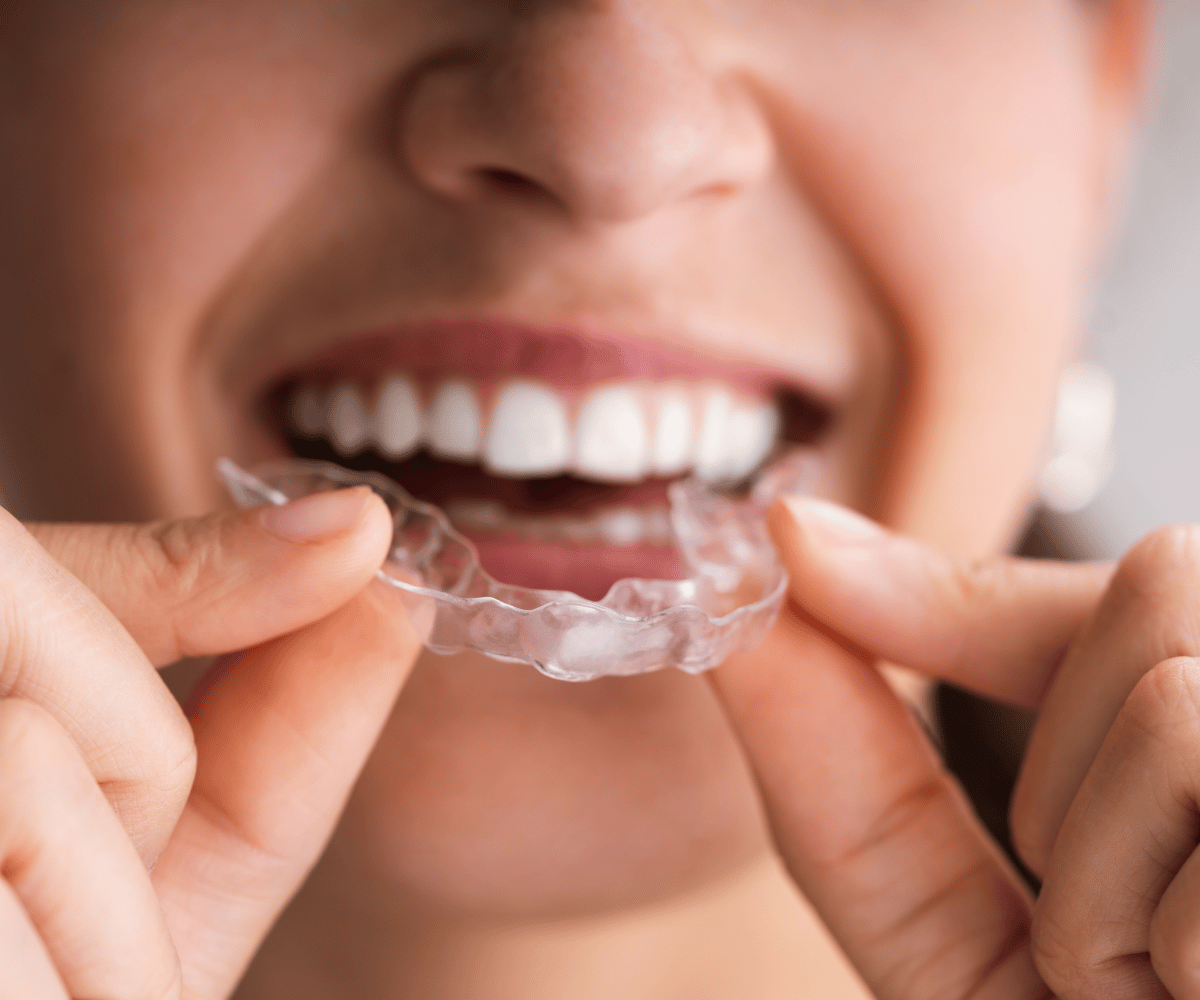 Invisalign